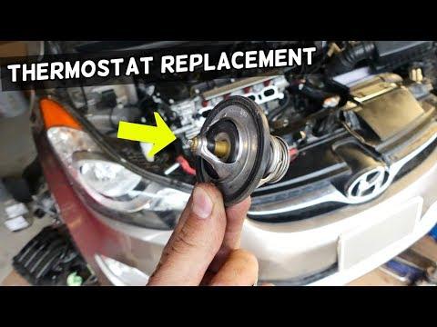 How to Replace the Thermostat on a 2018 Hyundai Kona (Cooling System Repair Guide)