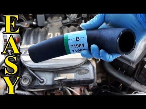 How to Replace the Upper or Lower Radiator Hose on a 2016 Kia Forte