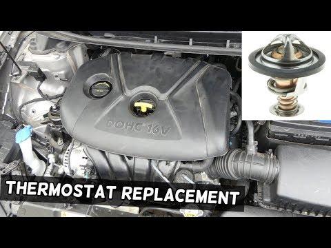 How to Replace the Thermostat on a 2016 Kia Forte (Cooling System Repair Guide)
