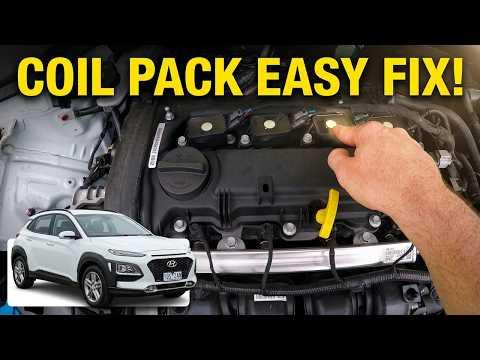How to Replace Hyundai Kona Ignition Coil Packs & Spark Plugs Tutorial (Kauai & Encino)